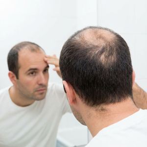 Pattern Hair Loss